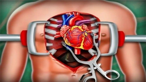 心脏手术模拟器截图（3）