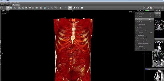 医疗影像3D软件